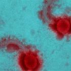 Misteriosa minaccia dal Brasile, cos'è lo Yaravirus? «90% dei geni sconosciuti»