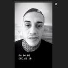 Francesco Chiofalo, il Lenticchio di Temptation Island, ha un tumore al cervello: il drammatico annuncio in un video su Instagram