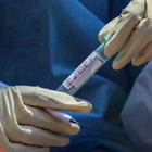 Coronavirus, 30 morti e 259 casi positivi in più: 156 in Lombardia, 46 in Emilia Romagna. Risalgono le terapie intensive: +2