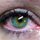 Sindrome dell'occhio secco: ne soffre il 60% delle donne dopo i 50 anni