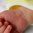 Bimba nasce con 26 dita tra mani e piedi: è affetta dalla polidattilia, una condizione molto rara