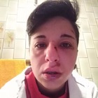 Giulia denuncia aggressione su Fb: «Picchiata perché lesbica, mi hanno detto: quelle come te devono morire»