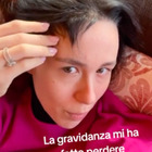 Aurora Ramazzotti, la perdita dei capelli durante la gravidanza: «Pensavo di rimanere pelata»