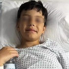 Bimbo di 10 anni azzannato da uno squalo: «Lesioni gravi alla gamba e ai nervi». La famiglia chiede aiuto online