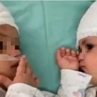 Mamma di 19 anni partorisce gemelli che appartengono a due padri diversi