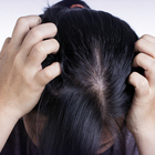 Infarto e ictus, un test del capello può predire il rischio: lo studio rivoluzionario