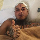 Francesco Chiofalo operazione riuscita, il post dal letto dell'ospedale: «Ce l’ho fatta... Sto bene»