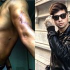 Niccolò Bettarini mostra le sue cicatrici su Instagram