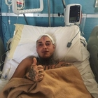 Francesco Chiofalo operato, tumore al cervello rimosso: «Ce l'ho fatta, sto bene»