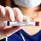 Coronavirus nel Lazio, 20 nuovi casi: 16 sono di importazione