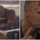 Mike Tyson prende a pugni in viso un passaggero in aereo