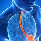 immagine Ritirato farmaco anti reflusso Pantoprazolo Eg: ecco i lotti interessati