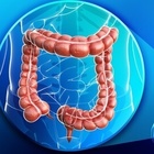 Morbo di Crohn, cos'è la malattia infiammatoria cronica dalle cause ancora sconosciute