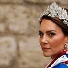 Kate Middleton, l'operazione eseguita da medici italiani del Gemelli. «Re Carlo sotto terapia con dolori alle ossa»