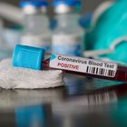 Coronavirus, gara-lampo della Consip: in arrivo 5.000 nuovi posti letto in terapia intensiva