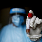 Coronavirus in Italia, 24 morti e 1.648 nuovi positivi con 40mila tamponi più di ieri. Boom di guariti
