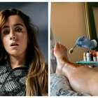 Sofia Goggia, la ferita della gamba rotta in allenamento (e operata lunedì) in una storia su Instagram