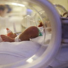 Neonata fatta nascere col cuore fuori dal torace: l'incredibile parto alla 38esima settimana