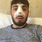 David Habib operato al naso: «Appena mi dimettono li denuncio»