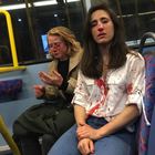 Lesbiche picchiate a Londra, la fotodenuncia dell'aggressione omofoba fa il giro del mondo