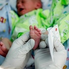 Neonato viterbese affetto da Sma curato con terapia genica: è il primo nel Lazio