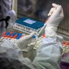 Coronavirus, come scoprire il contagio: dal tampone ai nuovi test che riducono i tempi