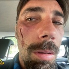 Vittorio Brumotti di Striscia la Notizia aggredito dai pusher a Mestre: «Ci hanno offerto sostanze, poi hanno visto la telecamera»