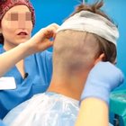 Muore a 39 anni durante il trapianto di capelli: «Infarto dopo l'anestesia»