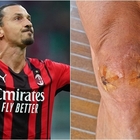 Ibrahimovic mostra le cicatrici sul ginocchio