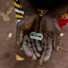 L'Onu ha un obiettivo, sradicare nel 2030 le mutilazioni genitali femminili