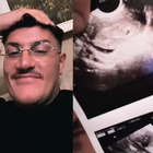 immagine Mario Mario avrà un figlio. L'annuncio del futuro papà tiktoker sui social