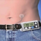 Diabete, infusore intelligente eroga insulina per 24 ore. «Come un pancreas artificiale»