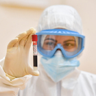 Coronavirus, il virologo che scoprì Ebola: «La pandemia è appena cominciata»