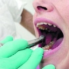 Ingoia il cacciavite dal dentista