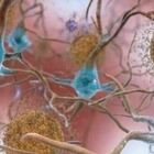 Alzheimer, la svolta: nuovo farmaco arresta la progressione della malattia nel cervello