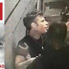 Fedez, il video della rissa con Iovino alla discoteca The Club di Milano: la foto del personal trainer con le ferite sul volto
