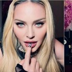 Madonna tra botox, spogliarelli e stravizi