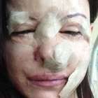 â¢ Dopo 2 anni e mezzo Lucia Annibali mostra il volto sfigurato