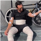 Alberto Contador, l'operazione choc: «Rimossi più di 100 lipomi». Come sta l'ex vincitore di Giro e Tour