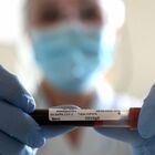 Coronavirus in Italia, tasso positività balza al 26,4%. Speranza: Sfida ancora aperta