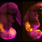 «Trova l'embrione con il minor rischio di malattie». L'annuncio choc di una società di ricercatori scatena le polemiche