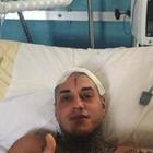Francesco Chiofalo, primo video dopo l'operazione: Alessio Bruno lo prende in giro, lui reagisce così