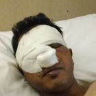 Nettuno, venditore di rose bengalese picchiato a sangue da due 20enni
