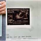 Mamma abortisce, a casa le foto del feto morto