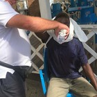 Nigeriano picchiato ad Anzio: confermato l'arresto, ma non c'è stato odio razziale