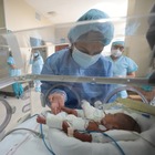 Coronavirus, bambino nato prematuro di appena 580 grammi guarisce dalla malattia