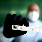 Coronavirus Lazio, 15 nuovi contagiati di cui 9 di importazione: un morto