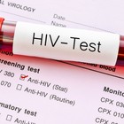 HIV, disinformazione e pregiudizi tra i giovani. Così aumentano paura e rischi