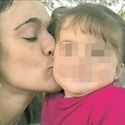 Il calvario di Lavinia, 4 anni: invalida gravissima dopo essere stata investita davanti all'asilo