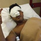 Le foto del bengalese picchiato 